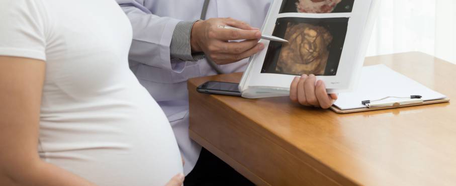 4D/3D Ultrasound Imaging